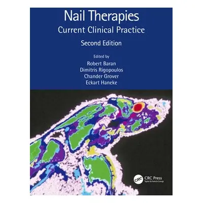 Nail Therapies