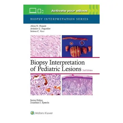 Biopsy Interpretation of Pediatric Lesions: Print + eBook with Multimedia - HUSAIN, ALIYA NOOR, 