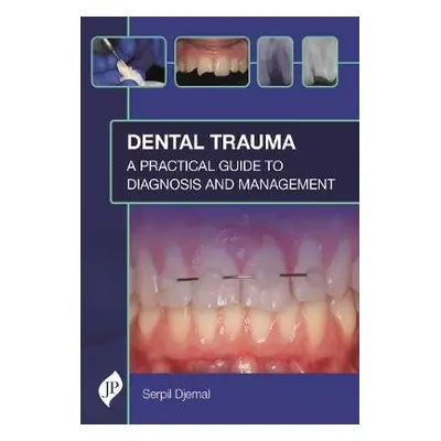 Dental Trauma - Djemal, Serpil