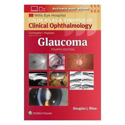 Glaucoma - Rhee, Douglas J.