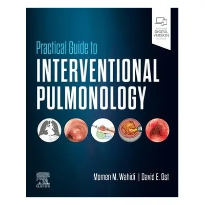 Practical Guide to Interventional Pulmonology