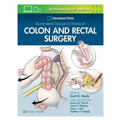 Cleveland Clinic Illustrated Tips and Tricks in Colon and Rectal Surgery - Steele, Scott