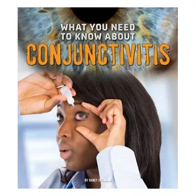 What You Need to Know about Conjunctivitis - Dickmann, Nancy