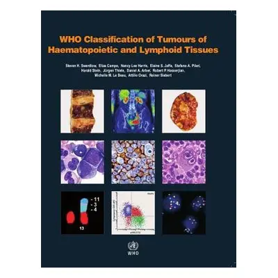 WHO classification of tumours of haematopoietic and lymphoid tissues - International Agency for 