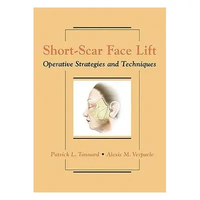 Short-Scar Face Lift - Tonnard, Patrick, MD a Verpaele, Alexis, MD.