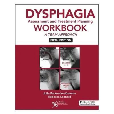 Dysphagia Assessment and Treatment Planning Workbook