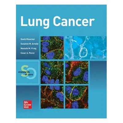 Lung Cancer: Standards of Care - Kloecker, Goetz a Fraig, Mostafa a Arnold, Susanne M. a Perez,