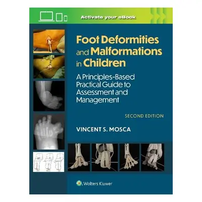 Foot Deformities and Malformations in Children - Mosca, Vincent