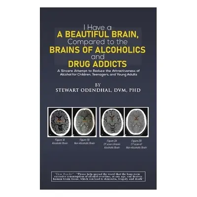 I Have a Beautiful Brain, Compared to the Brains of Alcoholics and Drug Addicts - Odendhal, DVM,