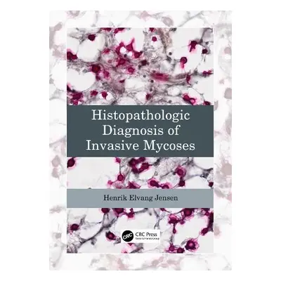 Histopathologic Diagnosis of Invasive Mycoses - Jensen, Henrik Elvang (University of Copenhagen,