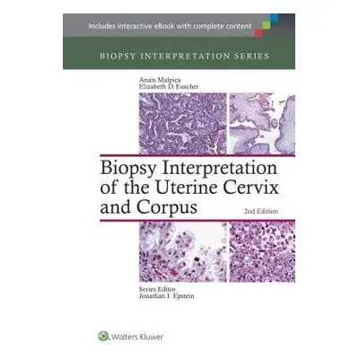 Biopsy Interpretation of the Uterine Cervix and Corpus