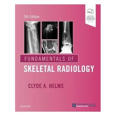 Fundamentals of Skeletal Radiology - Helms, Clyde A. (Professor of Radiology and Orthopaedic Sur