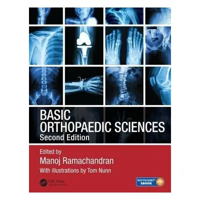 Basic Orthopaedic Sciences