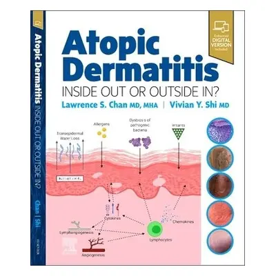 Atopic Dermatitis: Inside Out or Outside In