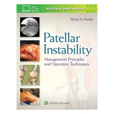 Patellar Instability