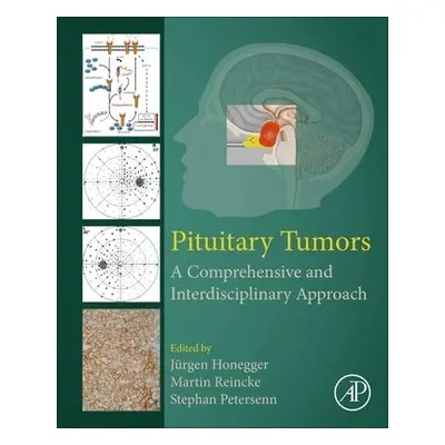 Pituitary Tumors