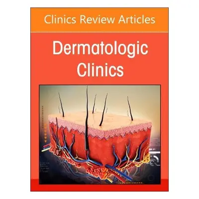 Diagnosing Skin Disease in Skin of Color, An Issue of Dermatologic Clinics