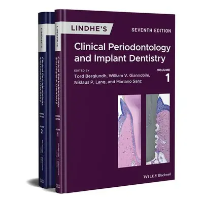 Lindhe's Clinical Periodontology and Implant Dentistry, 2 Volume Set