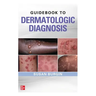 Guidebook to Dermatologic Diagnosis - Burgin, Susan