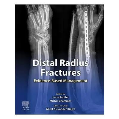 Distal Radius Fractures