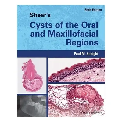 Shear's Cysts of the Oral and Maxillofacial Regions - Speight, Paul M. (School of Clinical Denti