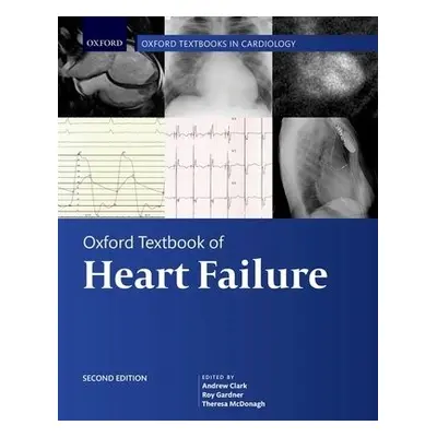 Oxford Textbook of Heart Failure