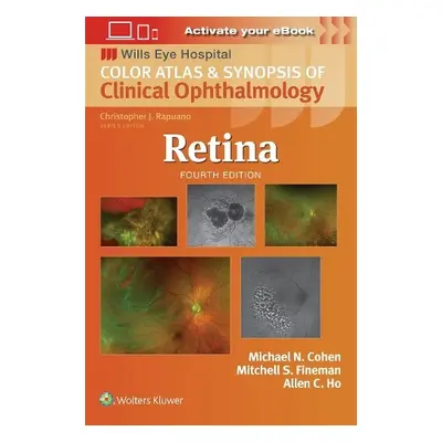 Retina - Fineman, Mitchell S.