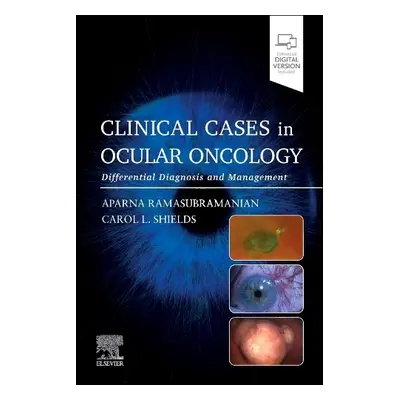 Clinical Cases in Ocular Oncology