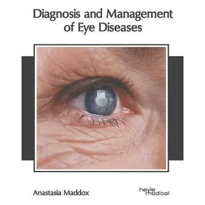 Diagnosis and Management of Eye Diseases