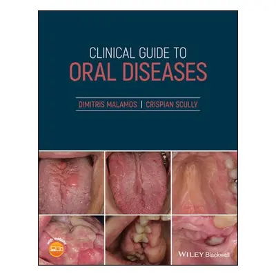 Clinical Guide to Oral Diseases - Malamos, Dimitris a Scully, Crispian, CBE (University College 