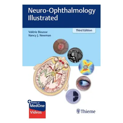 Neuro-Ophthalmology Illustrated - Biousse, Valerie a Newman, Nancy