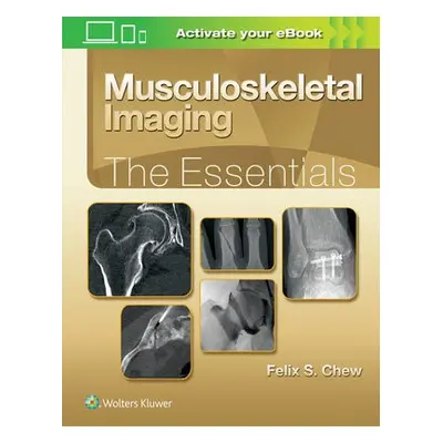 Musculoskeletal Imaging: The Essentials - Chew, Felix S.