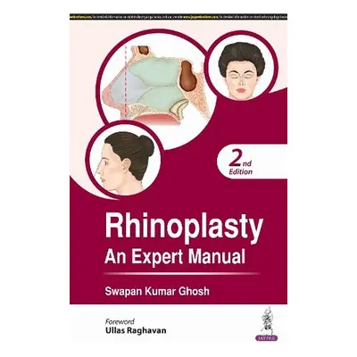 Rhinoplasty - Ghosh, Swapan Kumar