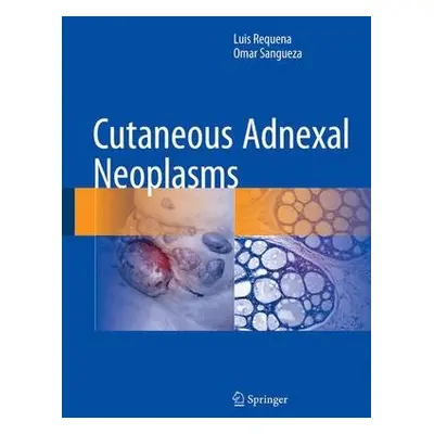 Cutaneous Adnexal Neoplasms - Requena, Luis a Sangueza, Omar