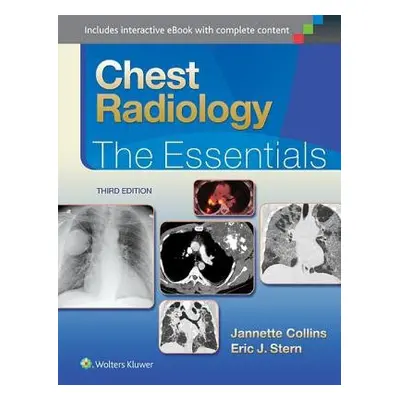 Chest Radiology: The Essentials - Collins, Janette a Stern, Eric J., MD