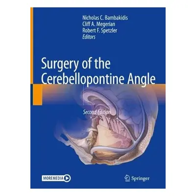 Surgery of the Cerebellopontine Angle