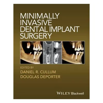 Minimally Invasive Dental Implant Surgery