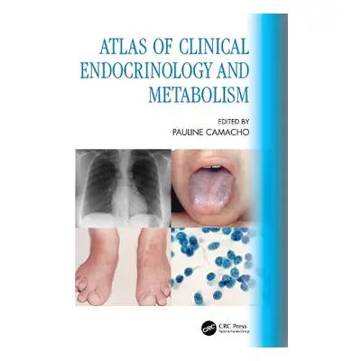 Atlas of Clinical Endocrinology and Metabolism