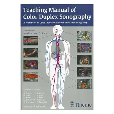 Teaching Manual of Color Duplex Sonography - Hofer, Matthias a MEDIDAK Publishing GmbH