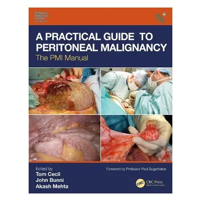 Practical Guide to Peritoneal Malignancy