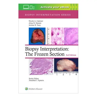 Biopsy Interpretation: The Frozen Section - Cipriani, Nicole A., MD a Husain, Aliya N. a Taxy, J