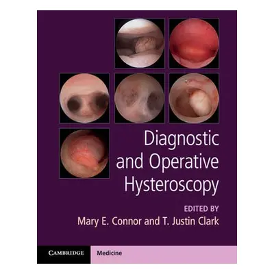 Diagnostic and Operative Hysteroscopy