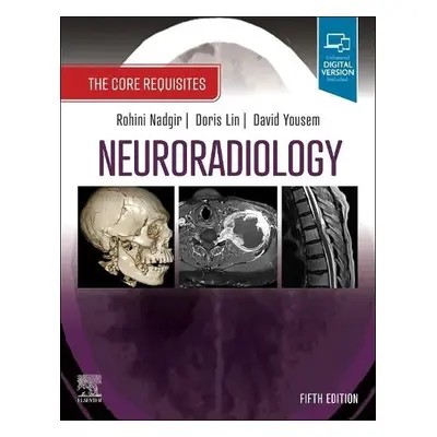 Neuroradiology