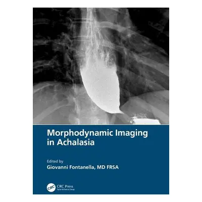 Morphodynamic Imaging in Achalasia