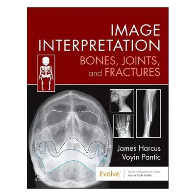 Image Interpretation: Bones, Joints, and Fractures - Harcus, James (Lecturer in Diagnostic Imagi