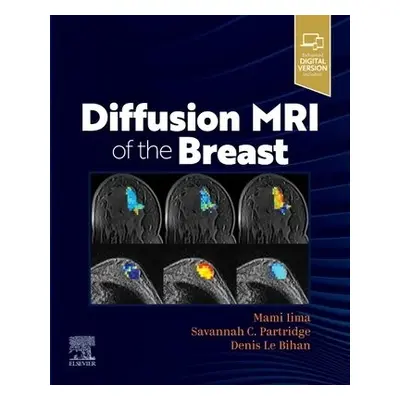 Diffusion MRI of the Breast