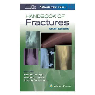 Handbook of Fractures