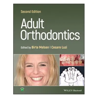 Adult Orthodontics