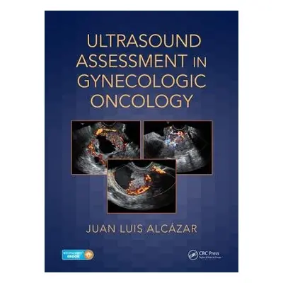 Ultrasound Assessment in Gynecologic Oncology - Alcazar, Juan Luis (University of Navarra, Pampl