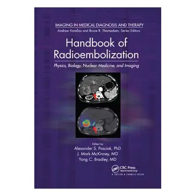 Handbook of Radioembolization